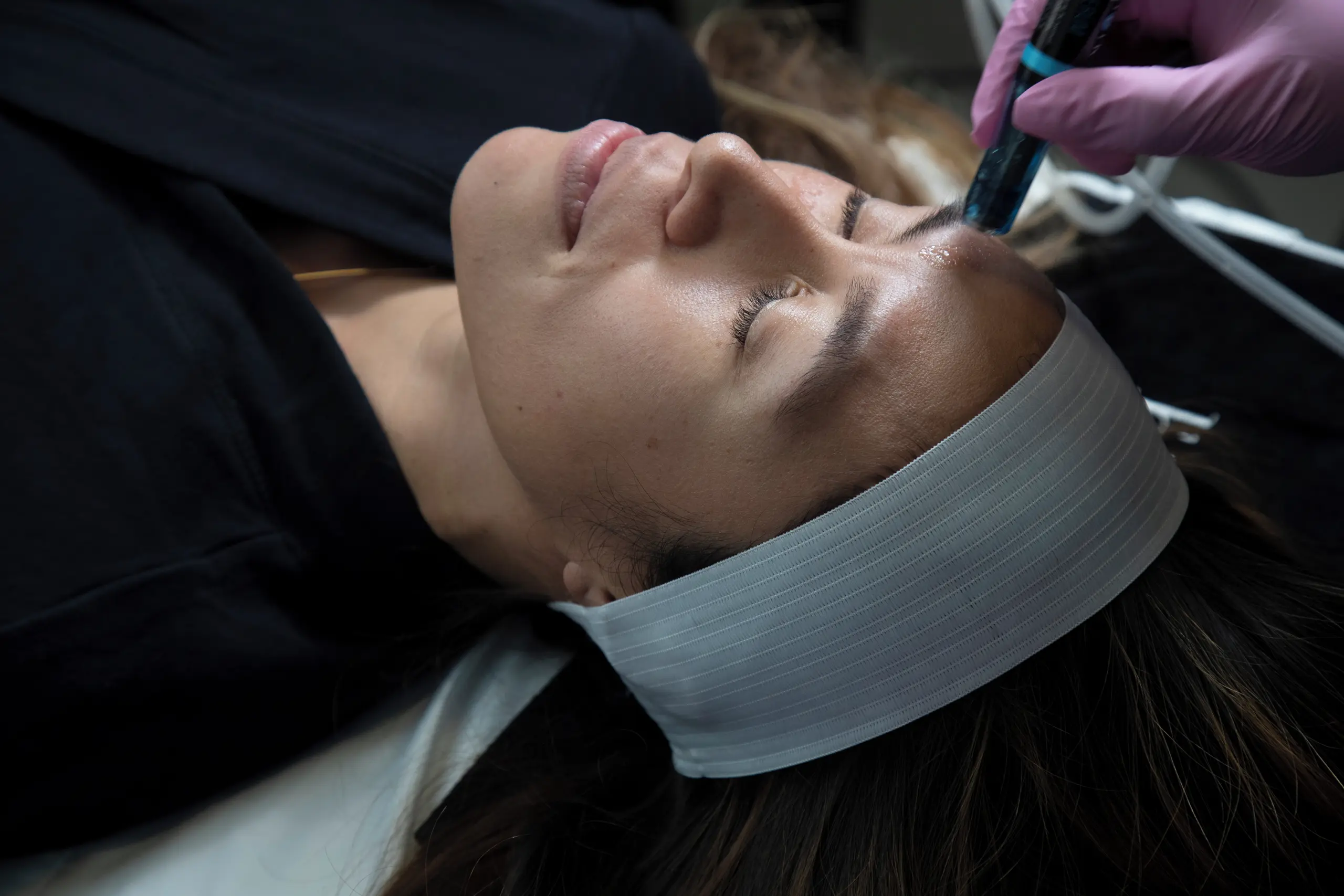 Friseur Thomas Bergemann Bochum Hydrafacial 01